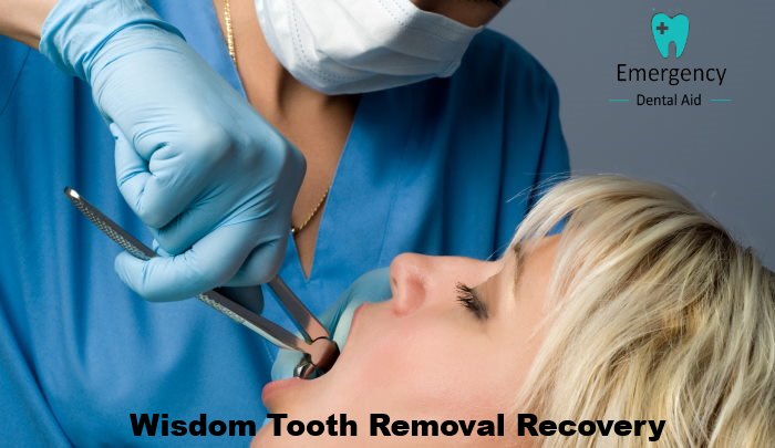 Recovery After Wisdom Tooth Removal